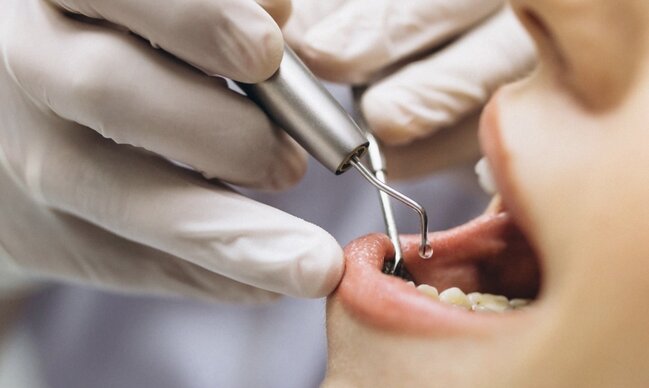 Bakıda mühafizəçi diş həkimi adı ilə xəstənin 11 dişini çəkib (VİDEO)