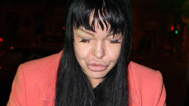 "Elit star" Cəmilə TANINMAZ HALDA - FOTO