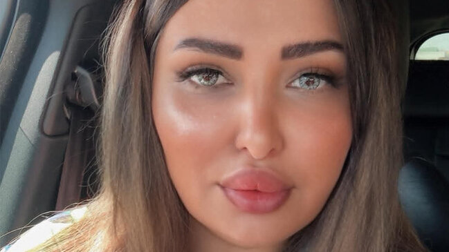 "İnex" şirkəti ilə lazeroloqlar arasında qalmaqal - Şirkət Taleh Heydərovun adını hallandırır