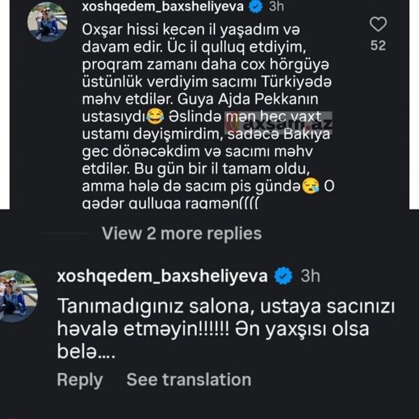 "Ajda Pekkanın stilisti saçlarımı məhv etdi"