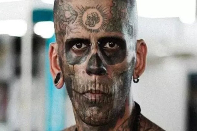 Bədəni 95 faiz döymə idi - Silinəndən sonra görünüşü ŞOKA SALDI