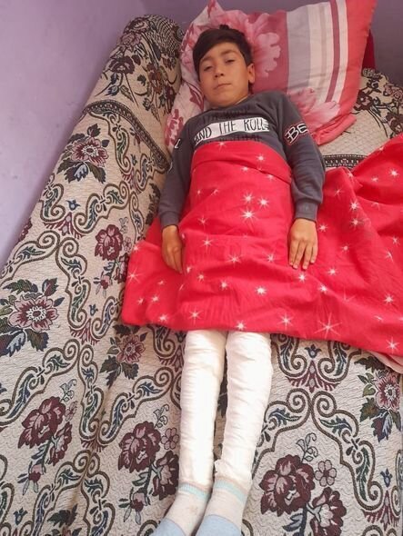 Əlinin müalicəsi üçün 200 manata ehtiyacı var - FOTO