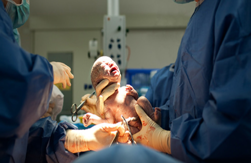 Azərbaycanda FACİƏ: 18 yaşlı qadın qeysəriyyə əməliyyatından sonra öldü