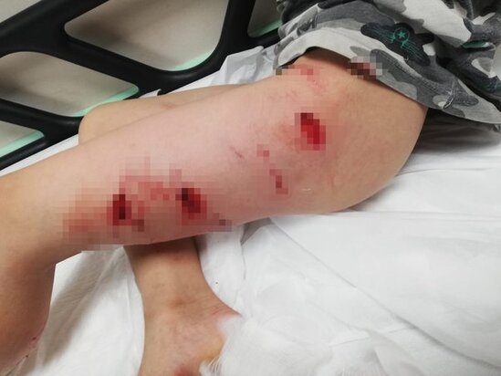 DƏHŞƏT: Daha bir PİTBULL hücumu - ANBAAN VİDEO