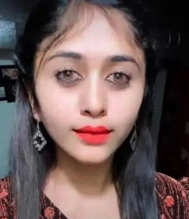 Məşhur aktrisa plastik əməliyyat zamanı öldü - FOTOLAR