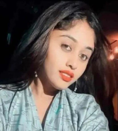 Məşhur aktrisa plastik əməliyyat zamanı öldü - FOTOLAR