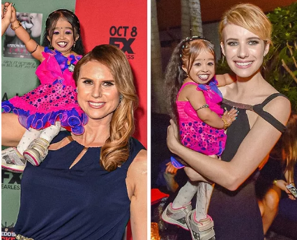 Dünyanın ən balaca qadını - Cəmi 63 sm boyu olan Amge - FOTO-VİDEO