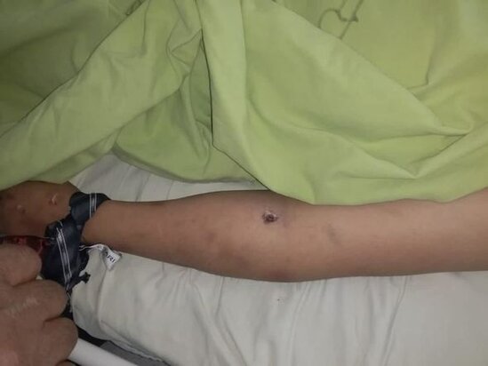 İntihar etdiyi deyilən 22 yaşlı Elnarənin ailəsi: "Onu öldürüblər" - FOTO