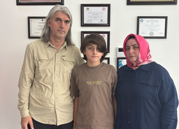 Stres oyuncağı partladı: 11 yaşlı uşağın ayağında ikinci dərəcəli yanıq yarandı - VİDEO