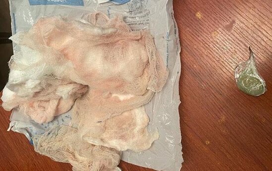 Yara sarğısında narkotik keçirmək istədi, yaxalandı