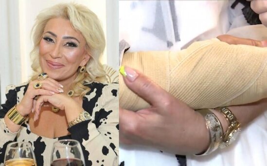 Nahidə Orucova qolunu sındırdı - VİDEO