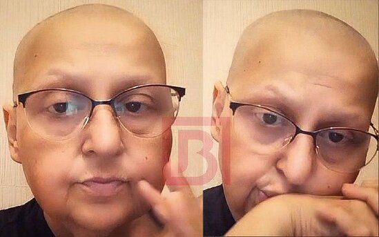 50-yə yaxın kimyaterapiya alan Toppuş bacı: "Xərçəng bütün bədənimə yayılıb" - VİDEO