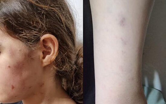 DİN-dən məktəbli qızın vəzifəli şəxslər tərəfindən döyülməsi iddiası ilə bağlı - Daha bir AÇIQLAMA