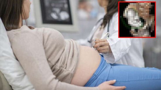 Qorxunc hadisə: Qadını müayinə edən həkim ŞOK YAŞADI - FOTOLAR