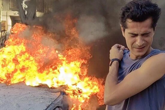 Çəkiliş meydançasında dəhşətli partlayış: Türkiyənin məşhur aktyoru xəsarət aldı