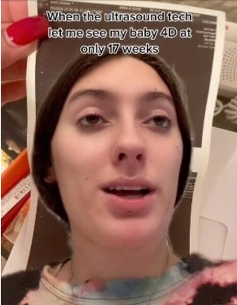 Hamilə qadın müayinə olundu: Uşağın 4d fotosuna baxanda ŞOKA DÜŞDÜ - FOTOLAR