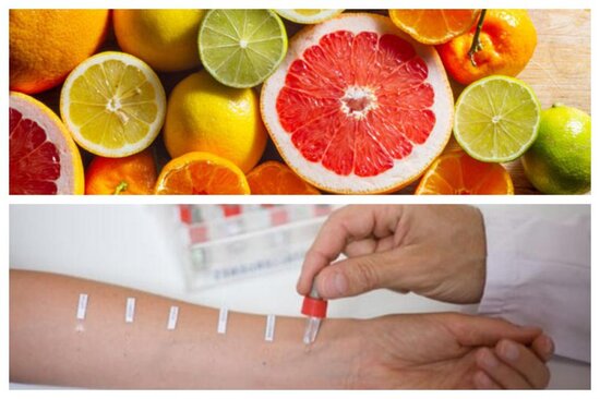 Sitrus və allergiya dövrü gəlir: "Pəhriz saxlamasalar, ağır fəsadlarla üzləşəcəklər"