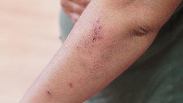 Azərbaycanda kişi hamilə arvadını döyüb - FOTO