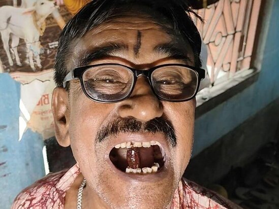 Qonşu qıza verdiyi sözə görə 26 il ağzında zeytun sümüyünü saxlayır