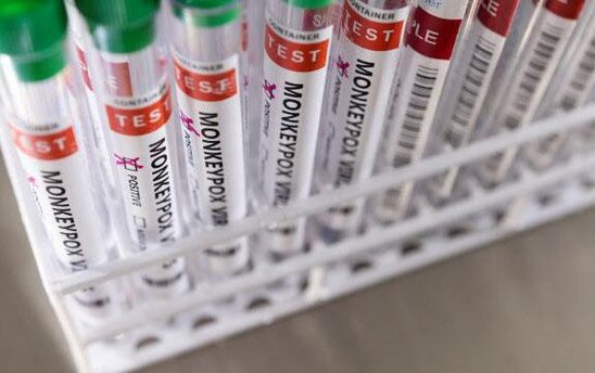 Bu ölkədə də meymunçiçəyi aşkarlandı