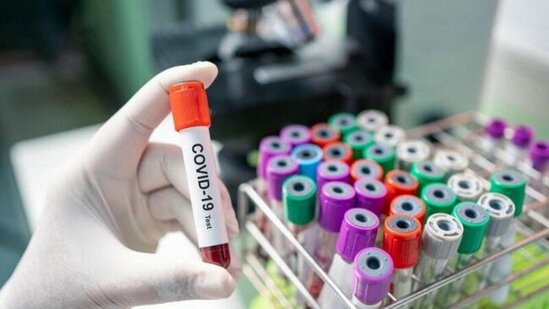 Allergiyası olanlar COVID-19-dan müalicə ala bilər?