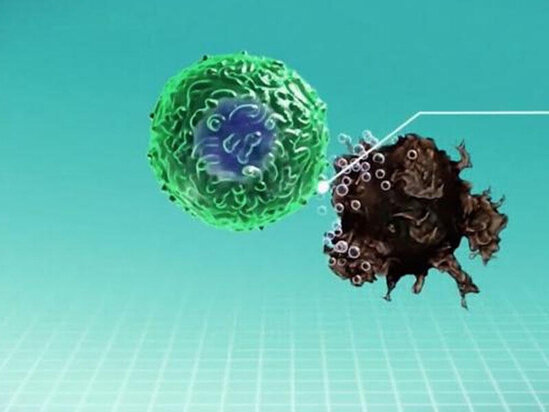 Xərçənglə effektli mübarizə yolları - VİDEO