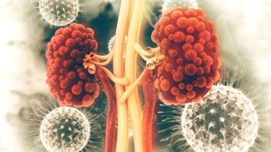 Koronavirusdan sonra böyrəklər 10 il qocalır – ALİMLƏR