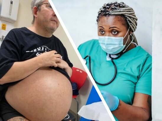 Bu kişi hamilə deyil, sadəcə böyrəkləri 35 kiloqramdır - FOTO