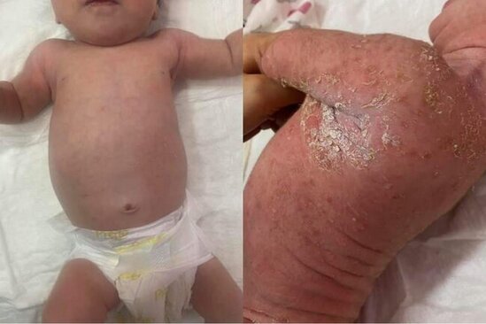 "40-ı çıxsın çimdirərik" deyib körpəni bu hala saldılar - FOTOLAR