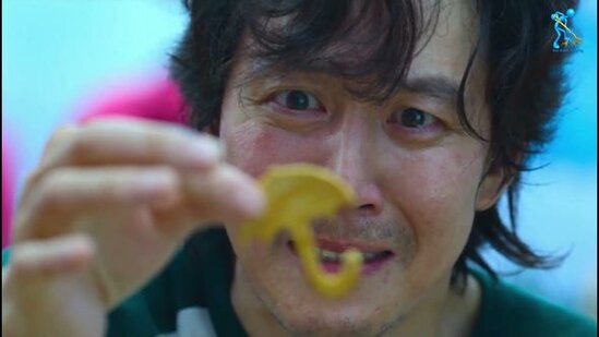 "Squid game"dəki nabatı bişirmək istəyən yeniyetmə yandı - FOTO/VİDEO