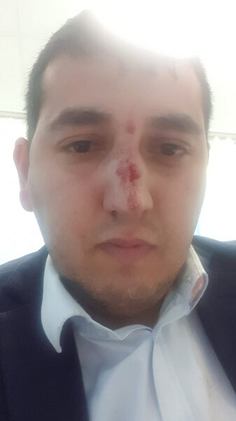 Bakıda rəis keçmiş işçisini kabinetində döydü - FOTO