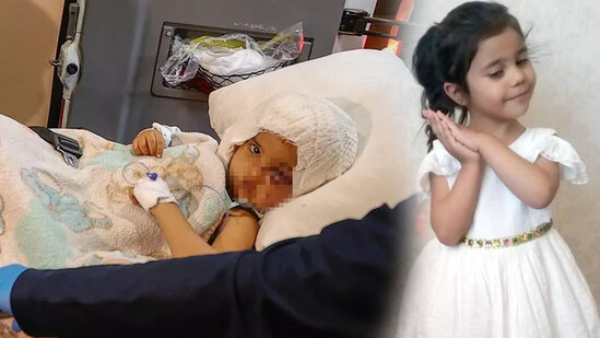 Pitbulların hücum etdiyi uşaq əməliyyat öncəsi verdiyi BU SUALLA ürək dağladı - VİDEO