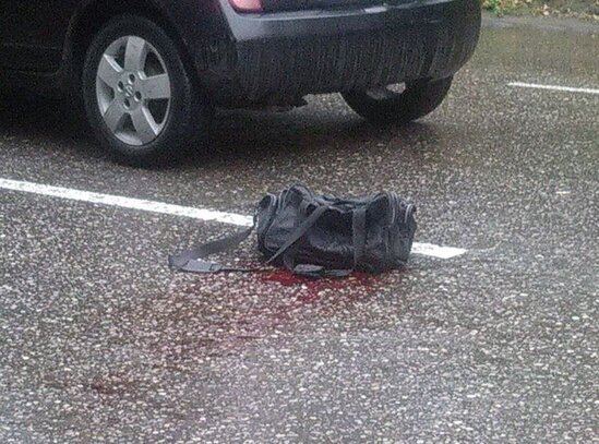 Bakıda avtomobilin vurduğu piyada xəstəxanada ölüb