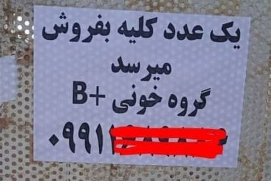 İranda çarəsiz insanlar buna əl atıblar- FOTO