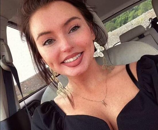 Dodağına gel doldurdu, dodağı çürüdü - FOTO