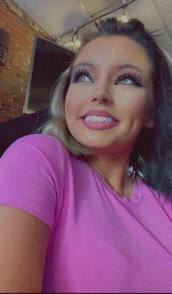 Dodağına gel doldurdu, dodağı çürüdü - FOTO