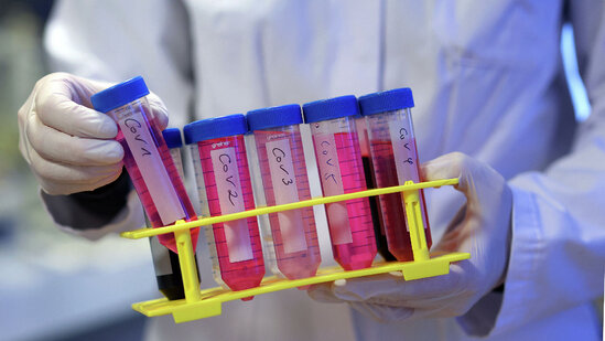 ÜST son sutkada koronavirusa yoluxanlar barədə məlumat yaydı