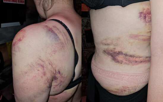 "Qayınatam dedi ki, mən bacarmıram artıq, arvadını öldür"