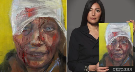 Xarkovda yaralanan müəllimin portreti 100 min dollara satıldı - FOTO