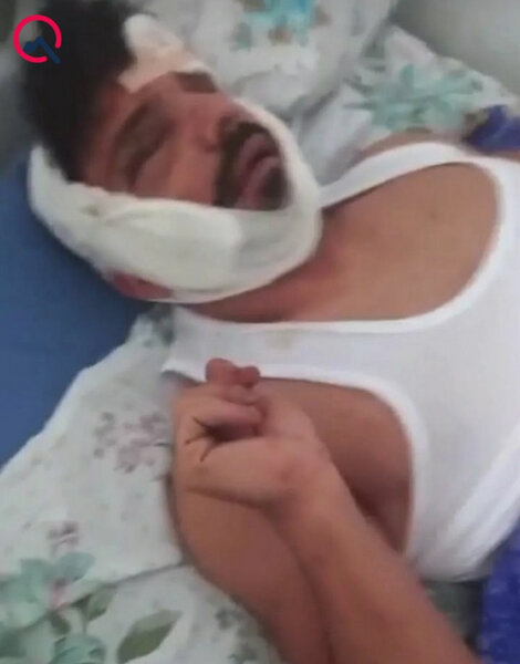 Partlayışda ağır xəsarət alan çempionun xəstəxanadan FOTOsu yayıldı