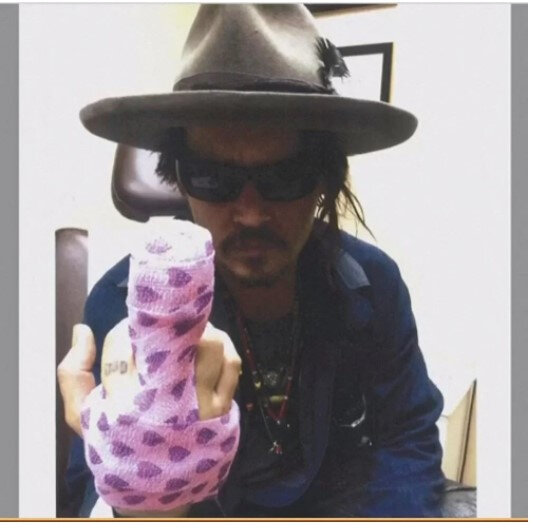 Şiddətə məruz qalan aktyor: "Arvadım siqareti üzümə basdı, atdığı içki şüşəsi barmağımı kəsdi" - FOTO