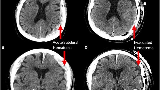 İnsan ölüm ayağında görün nəyi xatırlayır - BU YENİLİK HƏR KƏSİ ŞOKA SALDI