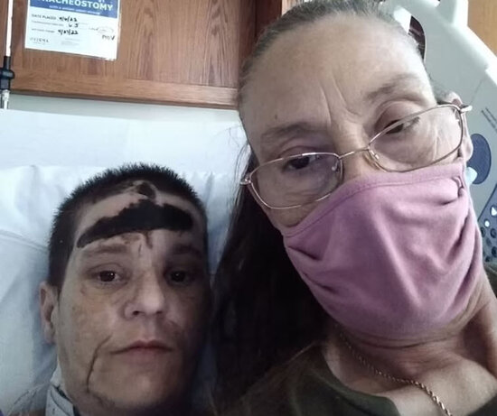 3 uşaq anasına itlər hücum etdi, qolları kəsildi - FOTOLAR