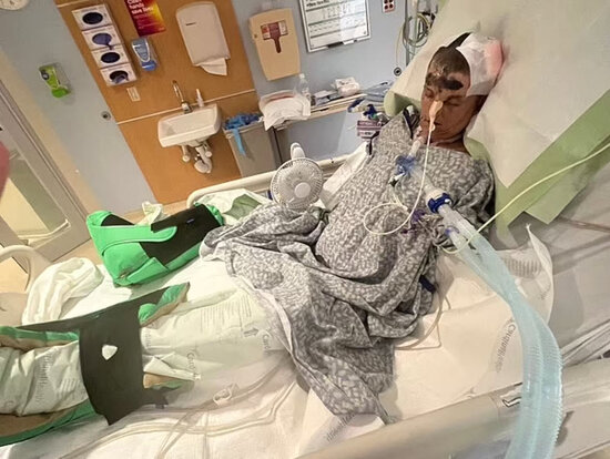 3 uşaq anasına itlər hücum etdi, qolları kəsildi - FOTOLAR