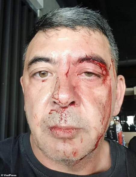 İdman zalında qorxunc hadisə: Ştanq qaldıran kişinin başından qantellə vurdu - VİDEO