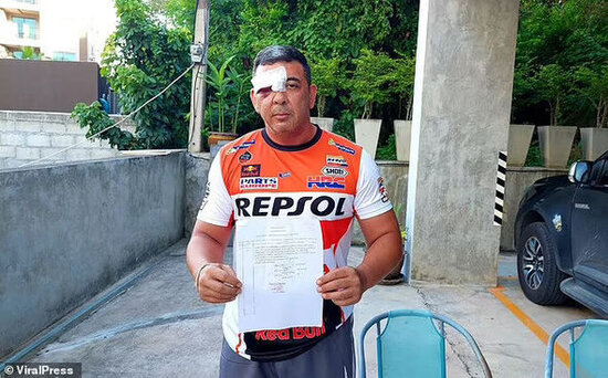 İdman zalında qorxunc hadisə: Ştanq qaldıran kişinin başından qantellə vurdu - VİDEO