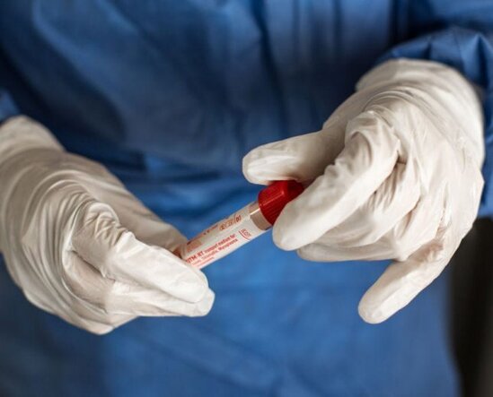 Meymunçiçəyi ilə bağlı daha bir XƏBƏRDARLIQ: Bu yolla keçir