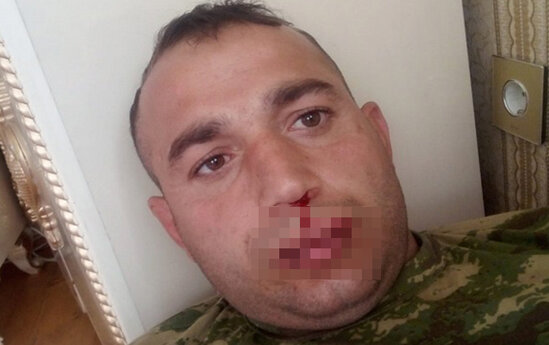 Ağzını tikən keçmiş MAXE ilə bağlı rəsmi açıqlama - FOTO