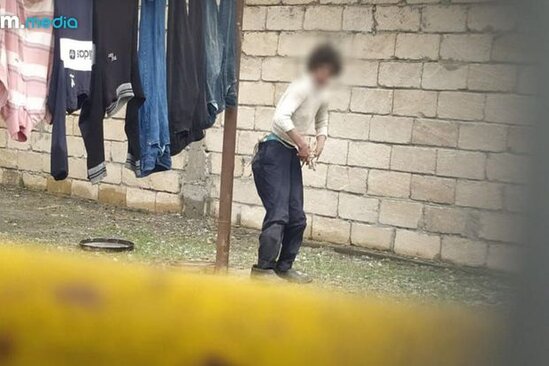 Atası tərəfindən işgəncələrə məruz qalan xəstə qızla bağlı MƏLUMAT - FOTO