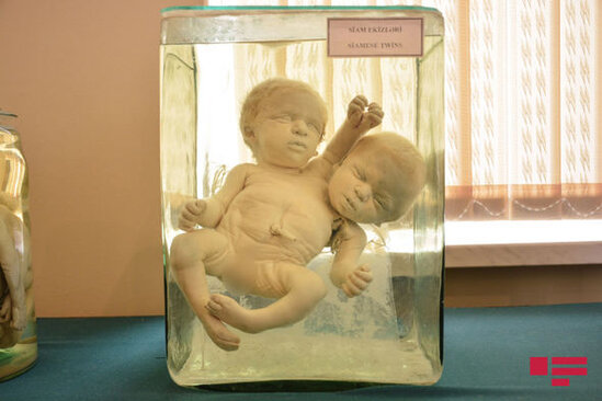 Alim: "Tək yaralı yerimiz meyit azlığıdır" - FOTO